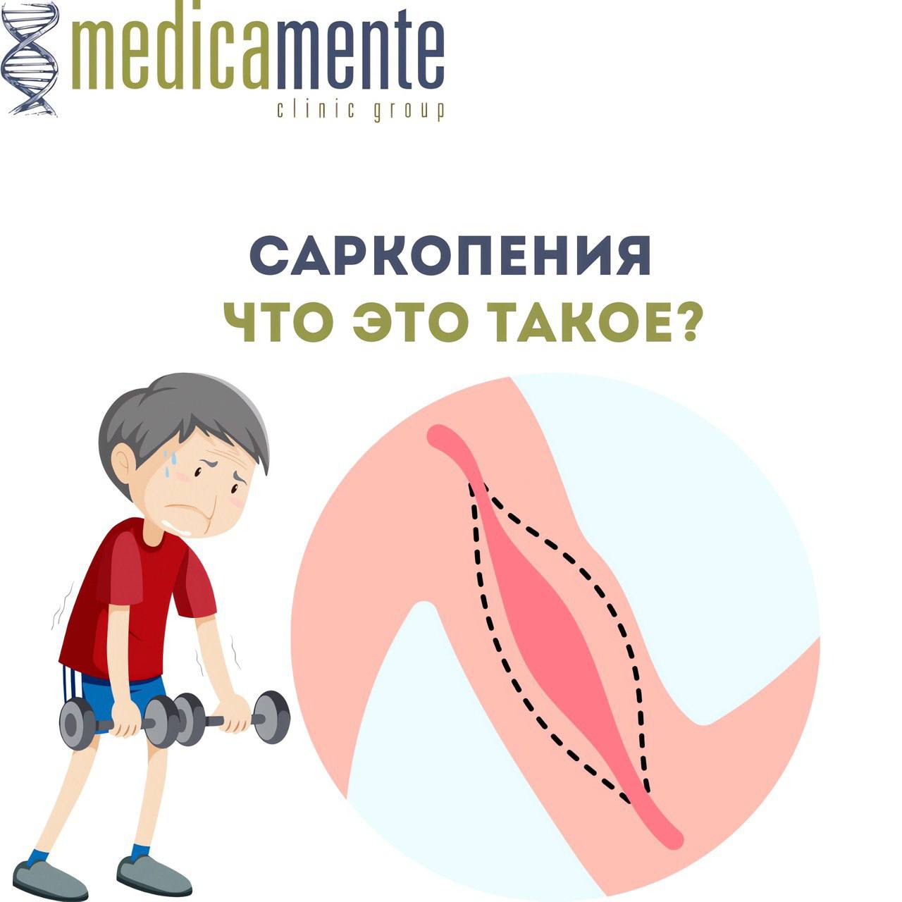 Что такое саркопения?